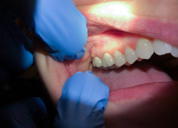 Best Walk-In Emergency Dental Services in Higginsville, MO