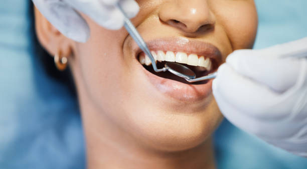 Best Knocked-Out Tooth (Avulsed Tooth) Treatment in Higginsville, MO
